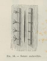 Suture enchevillée: Fig. 59